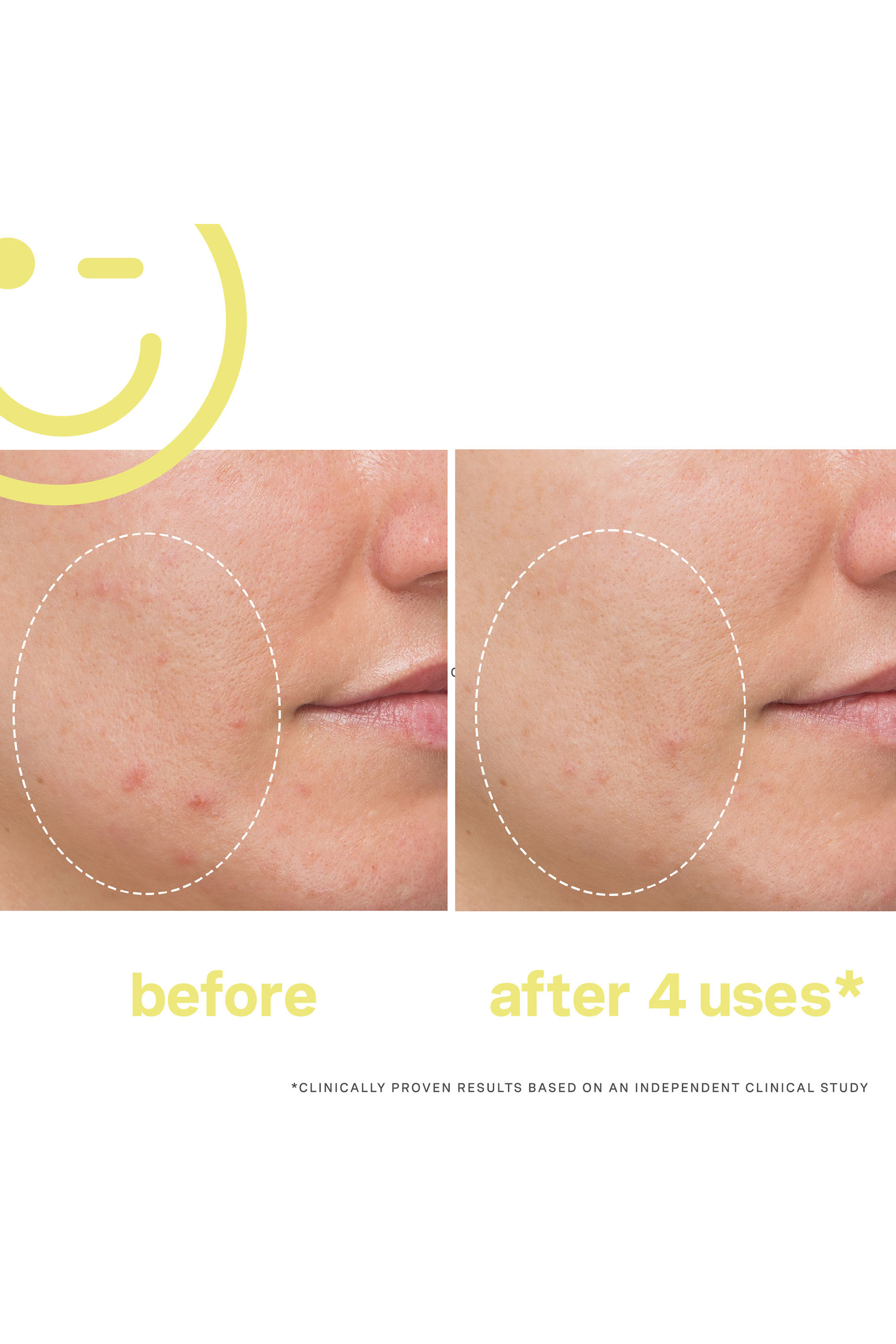 قناع فيشل ميغا-سي™ بفيتامين سي 30% لتفتيح البشرة