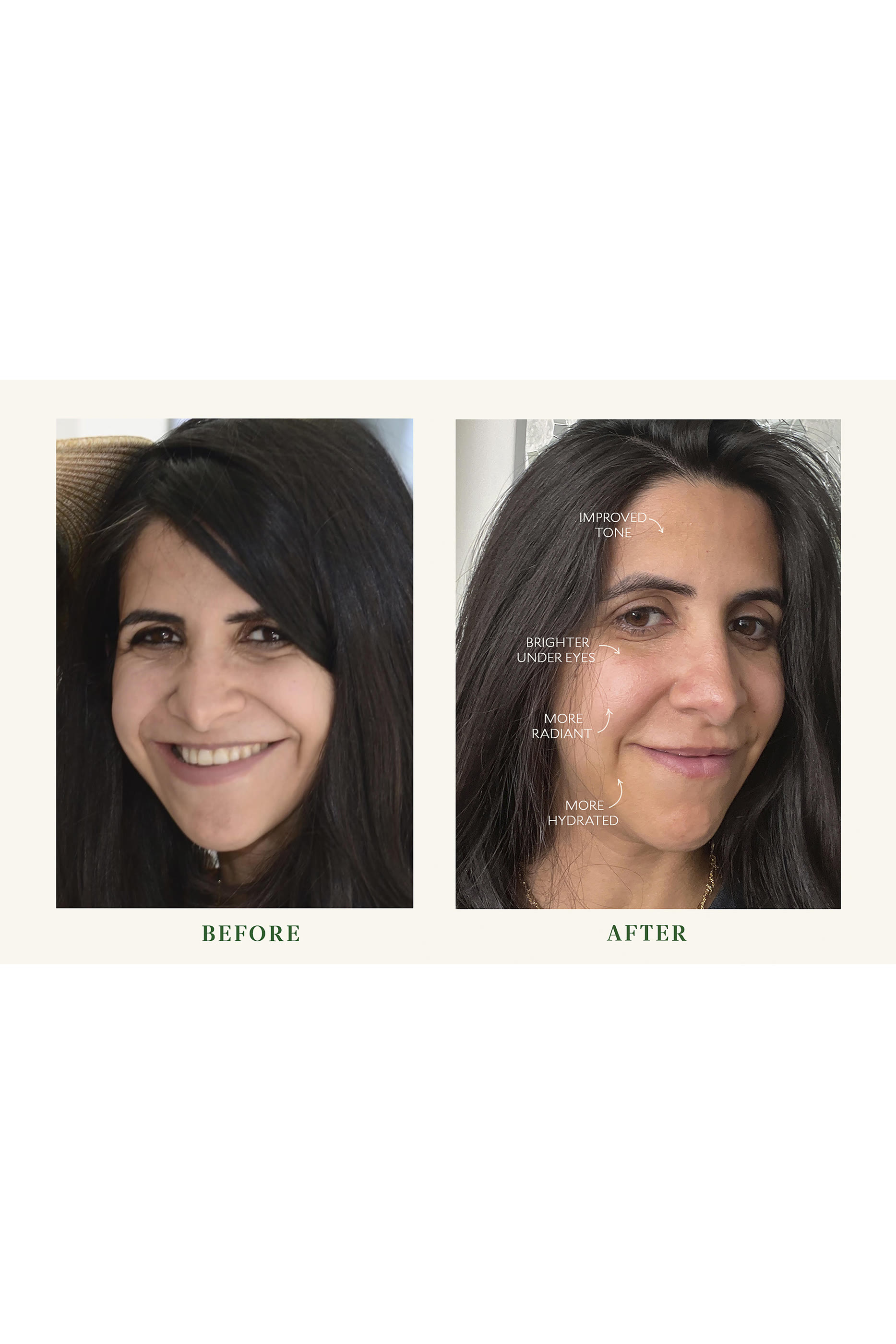 كريم بايو باريير لمنطقة العينين