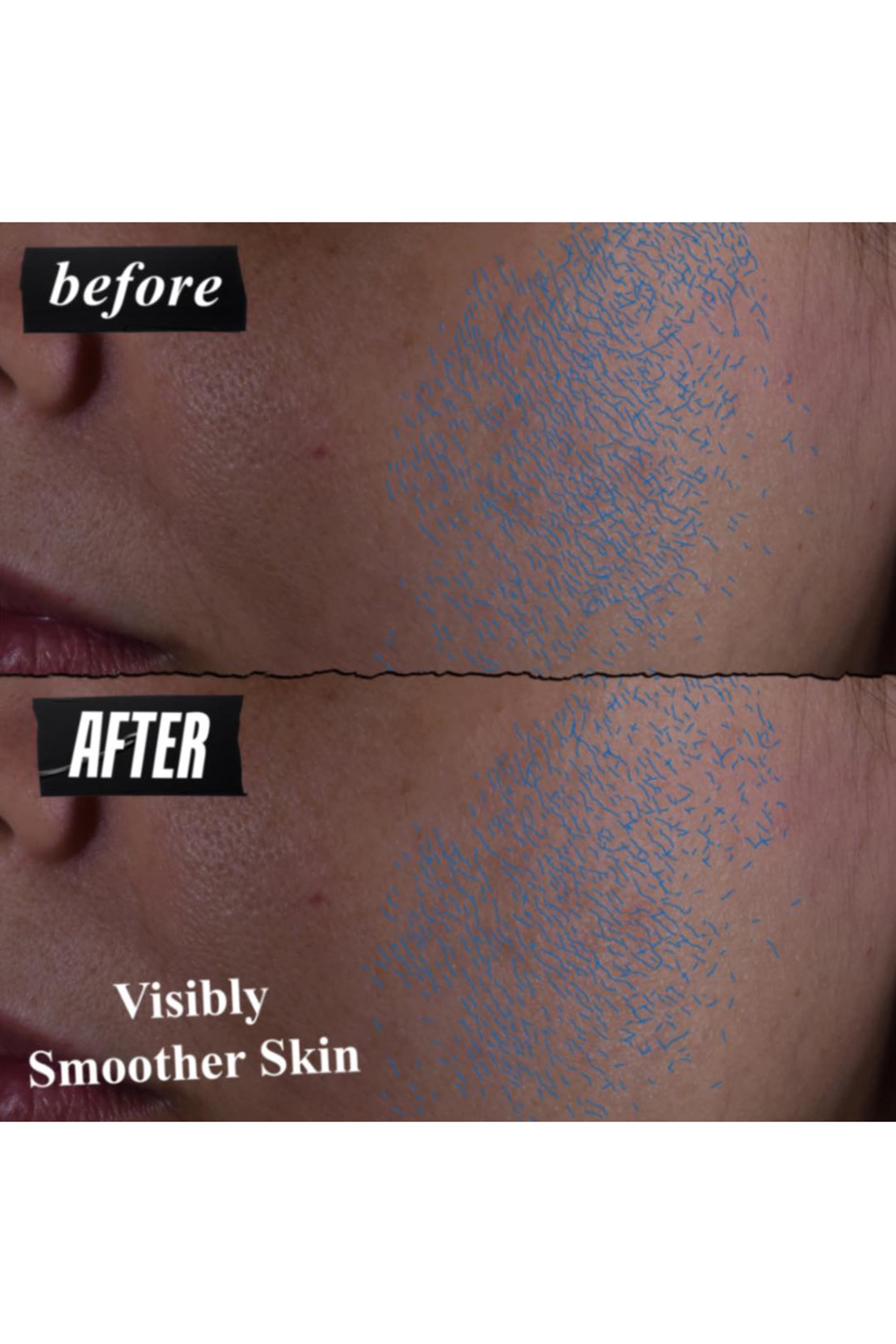 سيروم يومي كليرلي كوريكتيف لتقشير البشرة وتجديدها بالأحماض الثلاثية