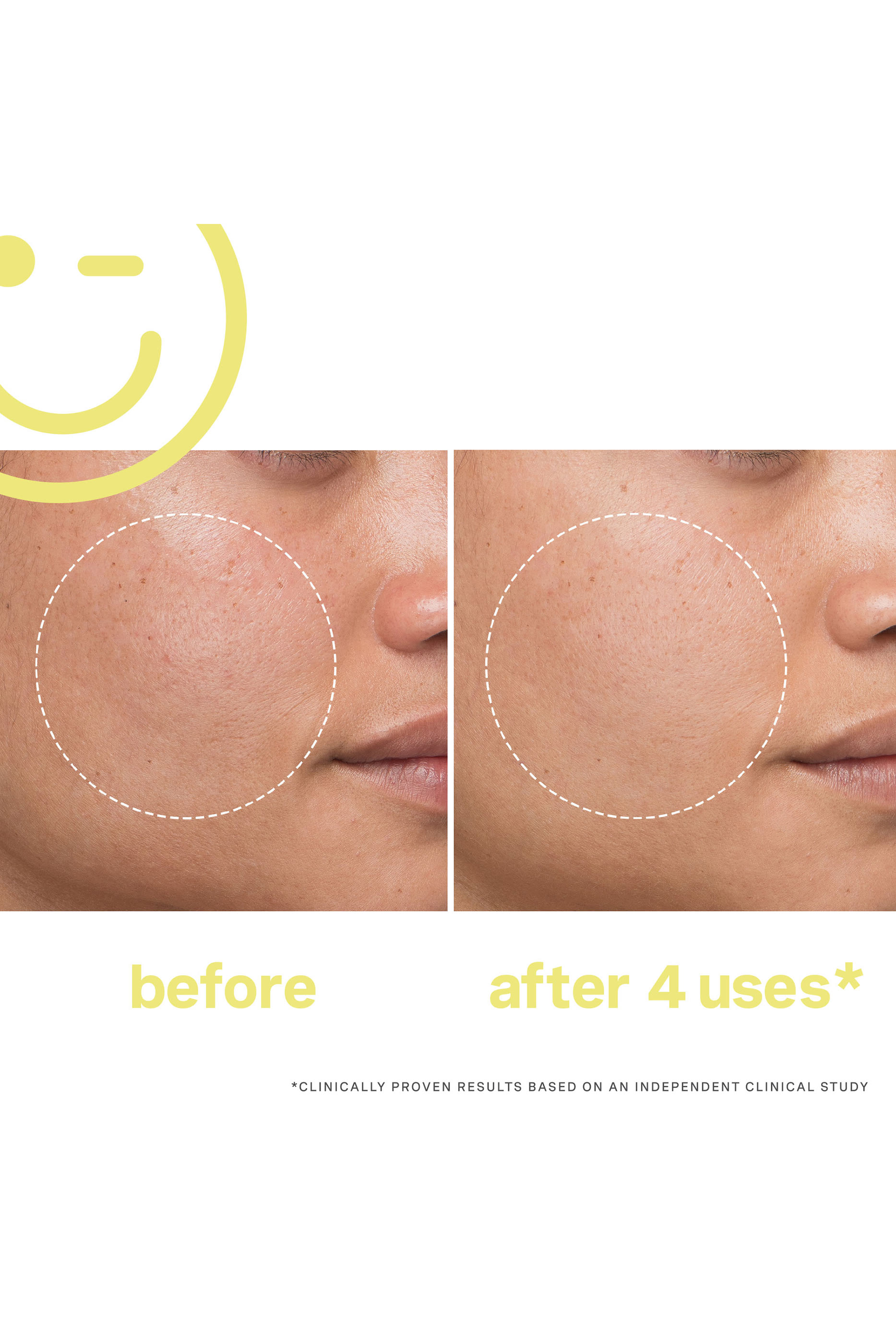 قناع فيشل ميغا-سي™ بفيتامين سي 30% لتفتيح البشرة