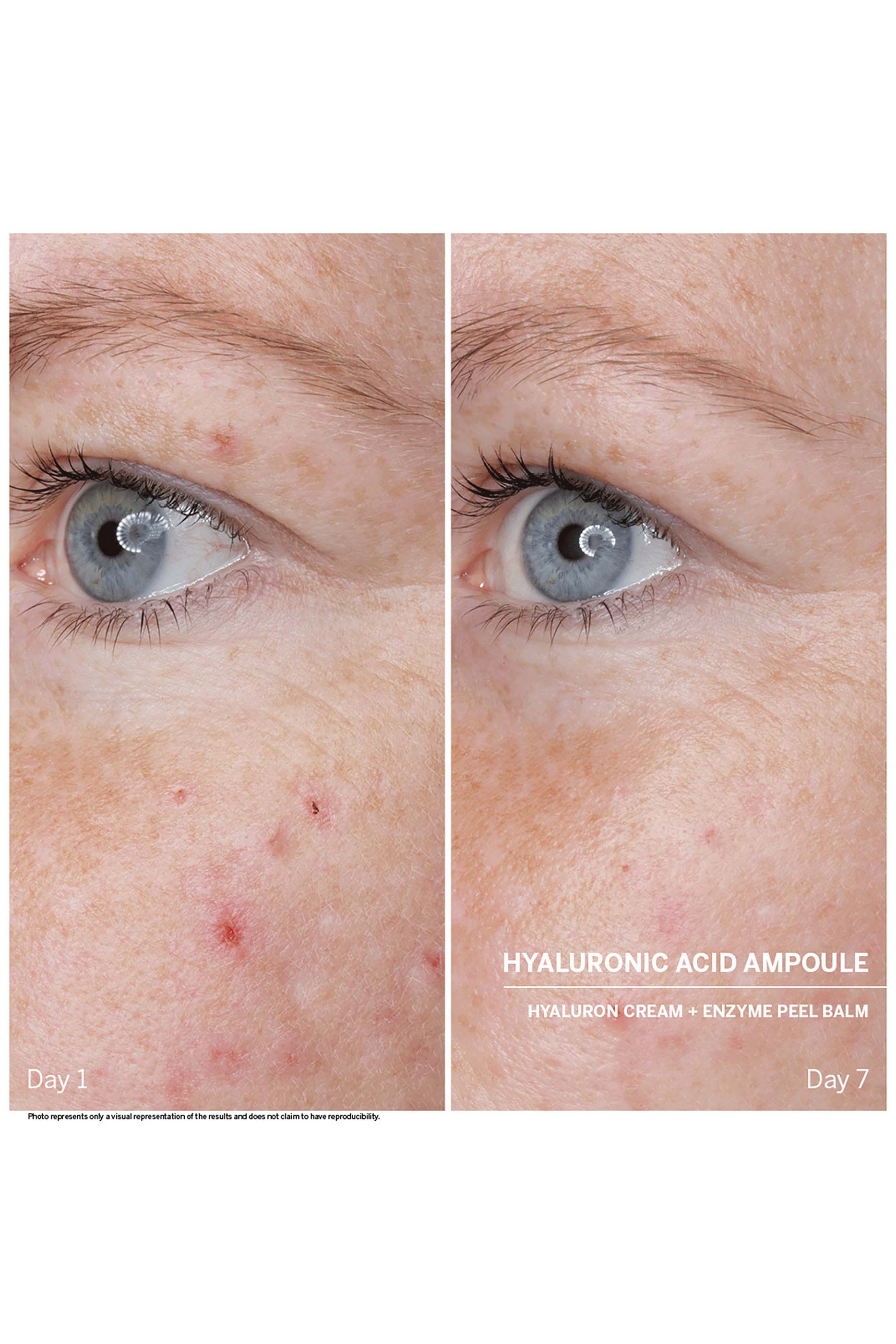 مجموعة أمبولة باور سيروم: حمض الهيالورونيك، 7 قطع