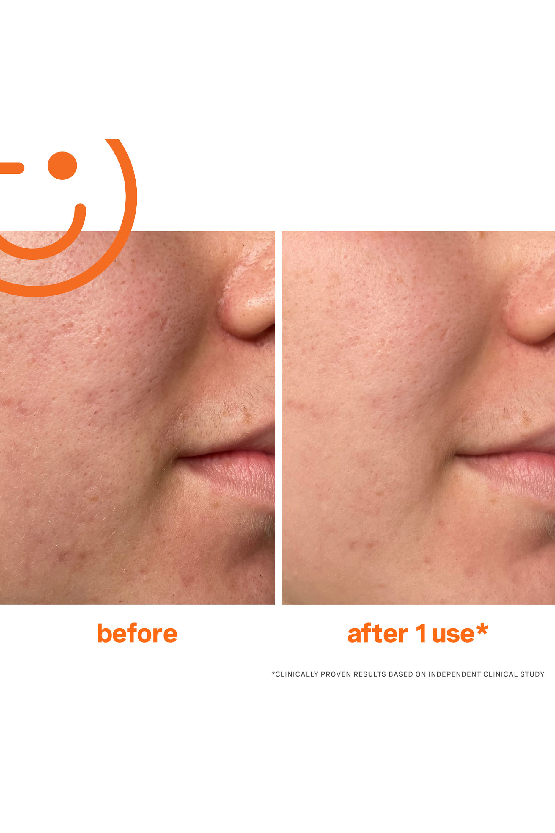 مستحضر علاجي اكيفوليكابت مقشر انتنسيف