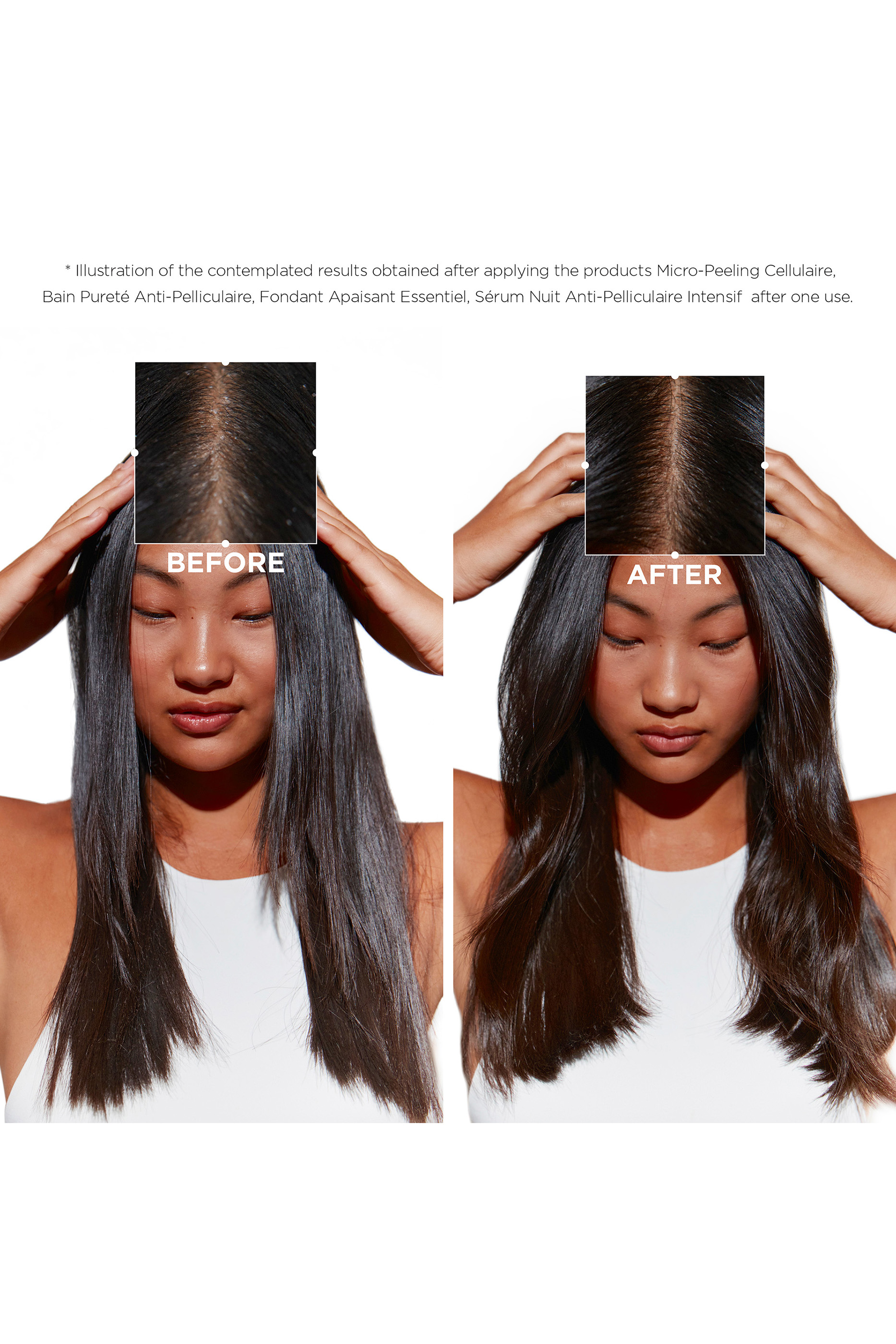 سيروم سيمبيوس ليلي مركز ومضاد للقشرة