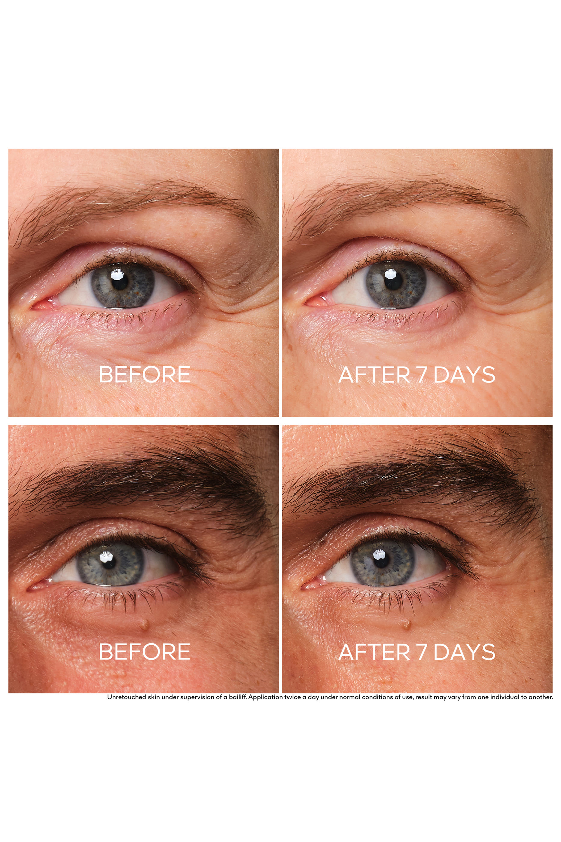 كريم أباي رويال لإصلاح البشرة