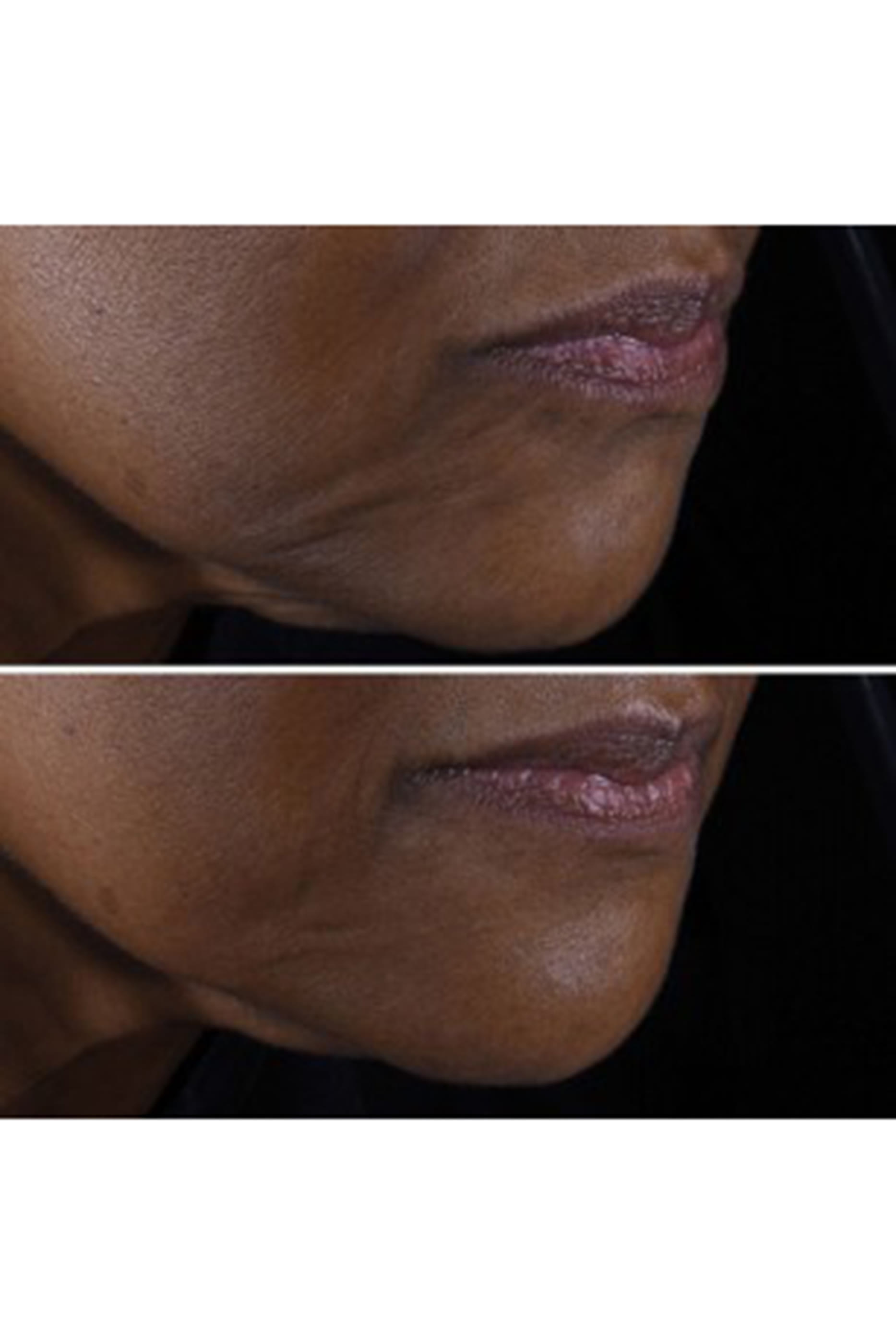 مجموعة سمارت كلينيكال ريبير لإصلاح الخطوط والتجاعيد، توفير 32&rlm;&rlm;&rlm;%