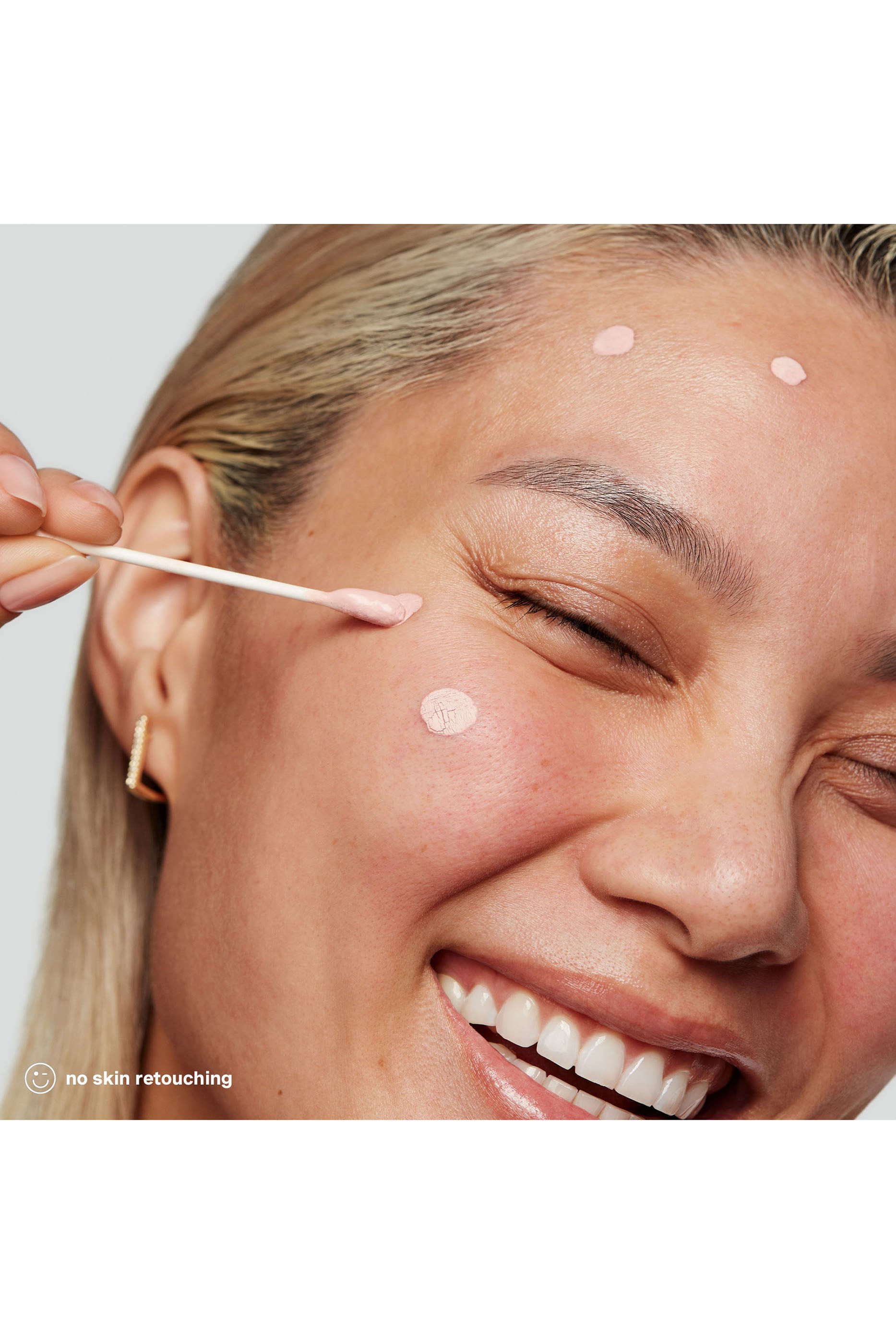 مستحضر علاجي اراديكايت للحبوب 10% كبريت